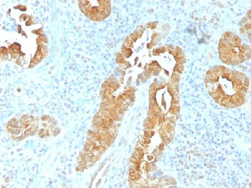 Villin (GI-Mucosal & Urogenital Brush Border Marker) Antibody