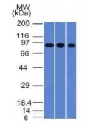 Villin (GI-Mucosal & Urogenital Brush Border Marker) Antibody