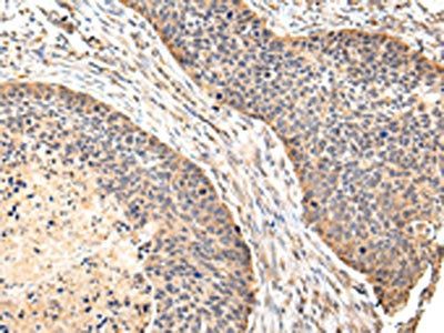 VIL1 Antibody