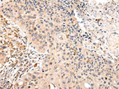VIL1 Antibody