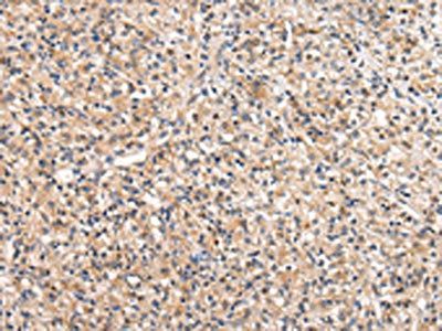 VIL1 Antibody
