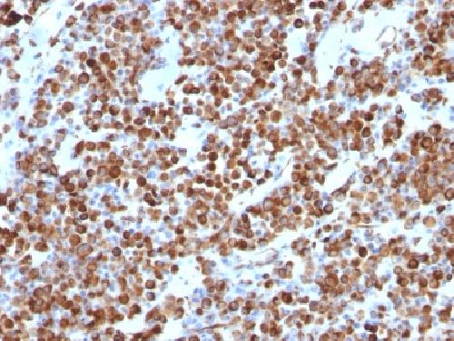 Vimentin (Mesenchymal Cell Marker) Antibody