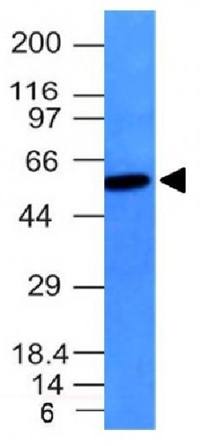 Vimentin (Mesenchymal Cell Marker) Antibody