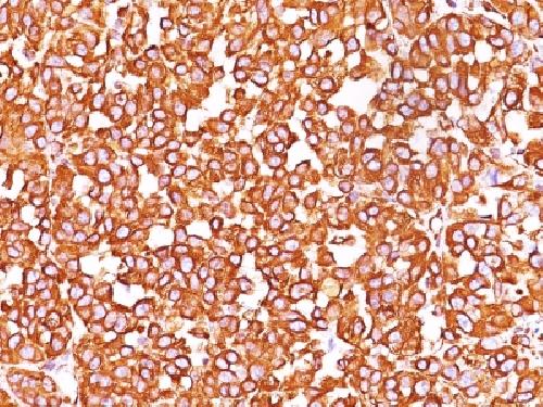 Vimentin (Mesenchymal Cell Marker) Antibody