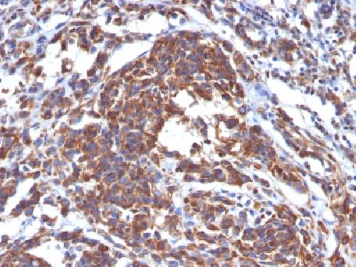 Vimentin (Mesenchymal Cell Marker) Antibody