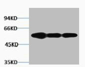 VIM Antibody
