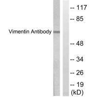 VIM antibody
