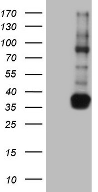 Vimentin Antibody