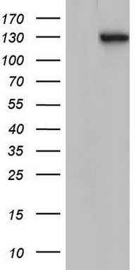 Vimentin Antibody