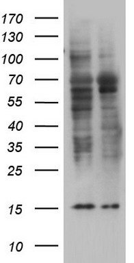 Vimentin Antibody