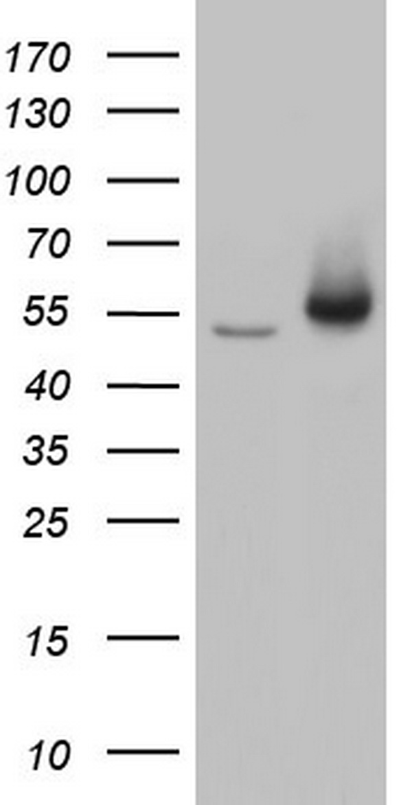 Vimentin Antibody
