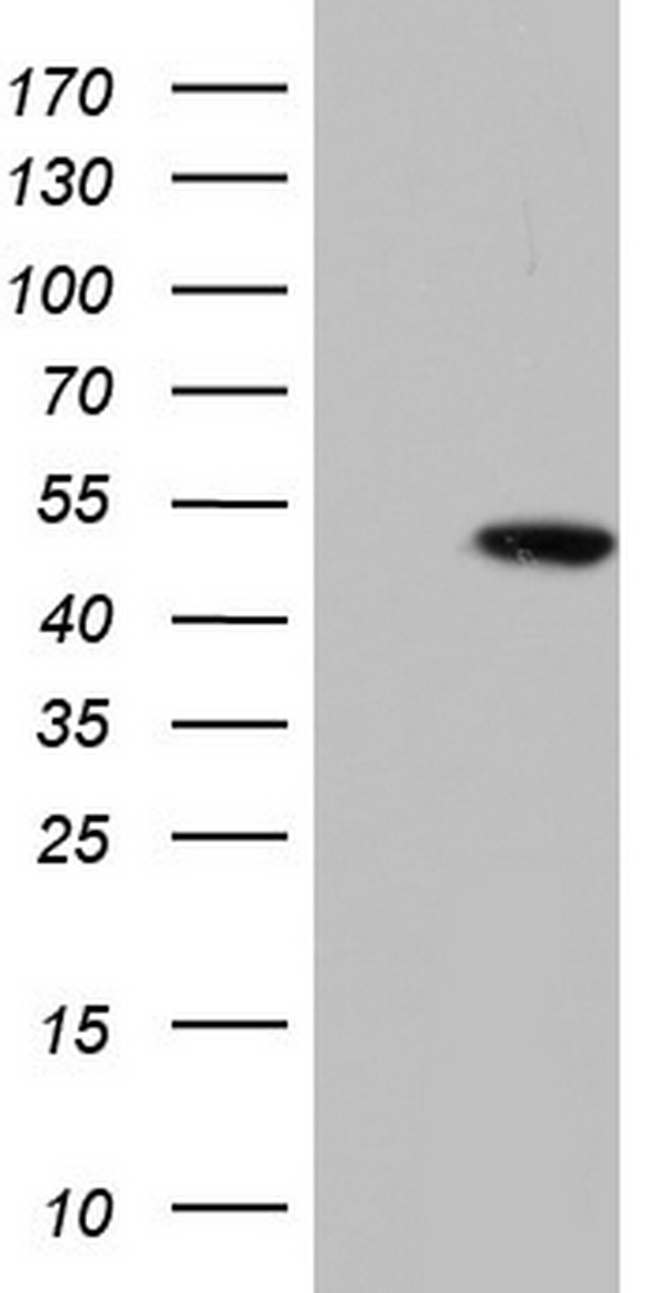 Vimentin Antibody