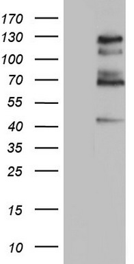 Vimentin Antibody