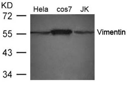 Vimentin Antibody