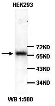 Vimentin Rabbit Polyclonal Antibody