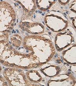 Vimentin Rabbit Polyclonal Antibody