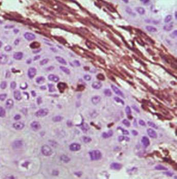 Vimentin Antibody