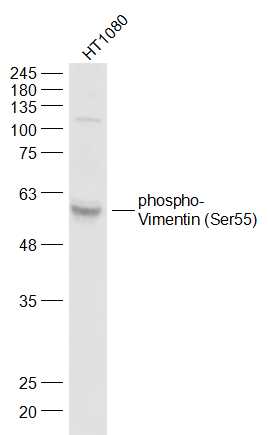 Vimentin (phospho-Ser55) antibody