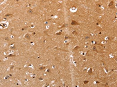 VIMP Antibody