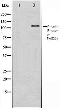 Phospho-Vinculin (Tyr822) Antibody