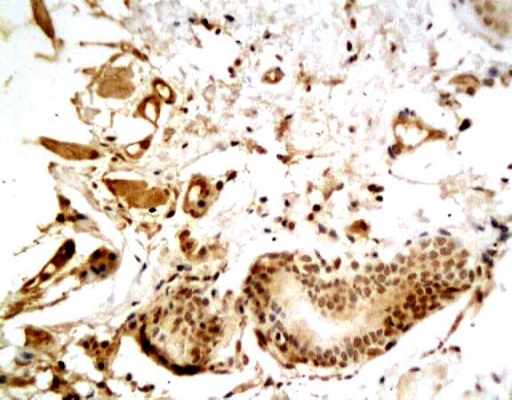 VIP Rabbit Polyclonal Antibody