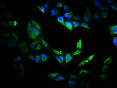 VIPAS39 antibody