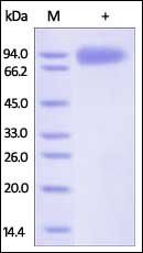 HIV-1 GP120 Protein, His Tag