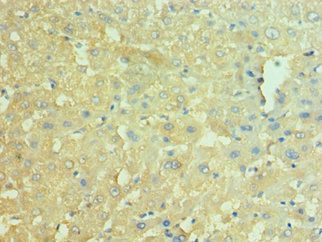 NAMPT Antibody