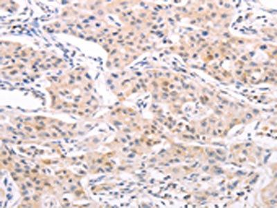 NAMPT Antibody