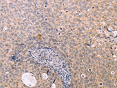 NAMPT Antibody