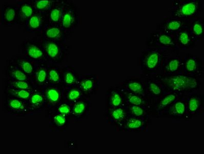 NAMPT Antibody