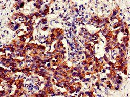 Visfatin 1 antibody