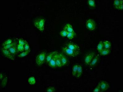 PROS1 Antibody