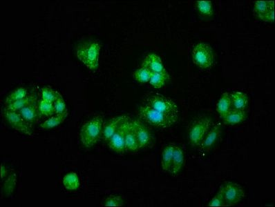 Vitamin K-dependent protein S antibody