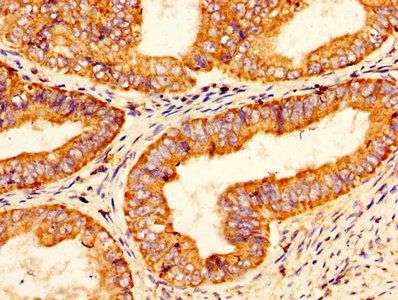 Vitamin K-dependent protein S antibody