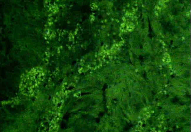 Vitamin D Receptor Rabbit Polyclonal Antibody (FITC)