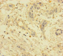 VKORC1L1 Antibody