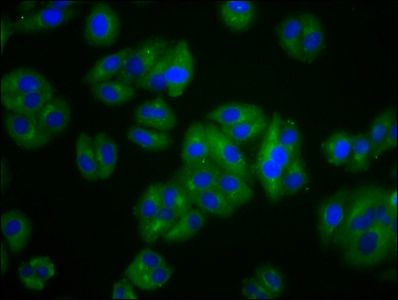 VLDLR Antibody
