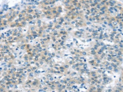 VLDLR Antibody