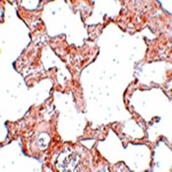 VLK Antibody