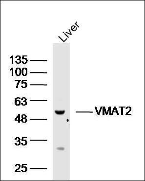 VMAT2 antibody
