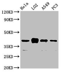 VN1R1 Antibody