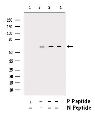 AKT (Phospho-Ser473) antibody