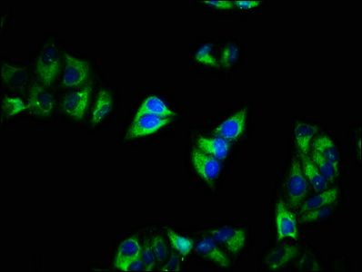 Voltage-dependent calcium channel subunit alpha-2/delta-1 antibody