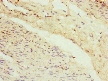 VPS11 Antibody