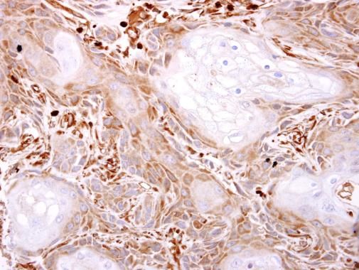 VPS11 antibody