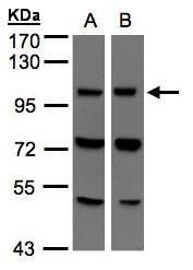 VPS11 core subunit of CORVET and HOPS complexes Antibody