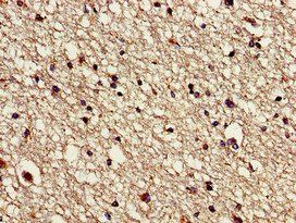 VPS16 Antibody