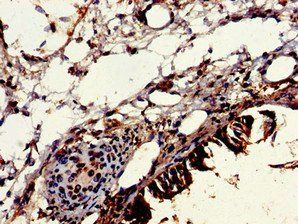 VPS16 Antibody