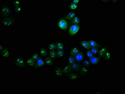 VPS25 Antibody